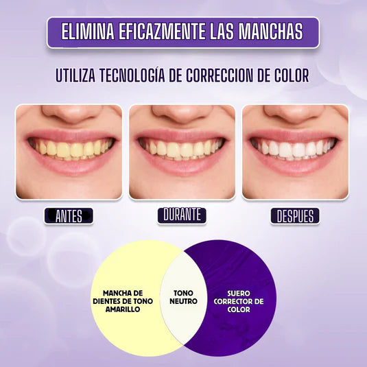 Hismile Blanqueador Dental Eliminador De Manchas